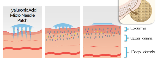 Correze intensive eyepatch